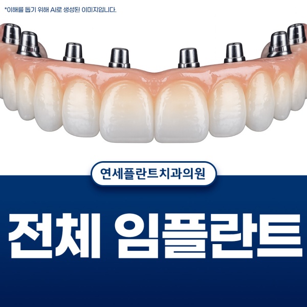 4. 전체 임플란트.jpg