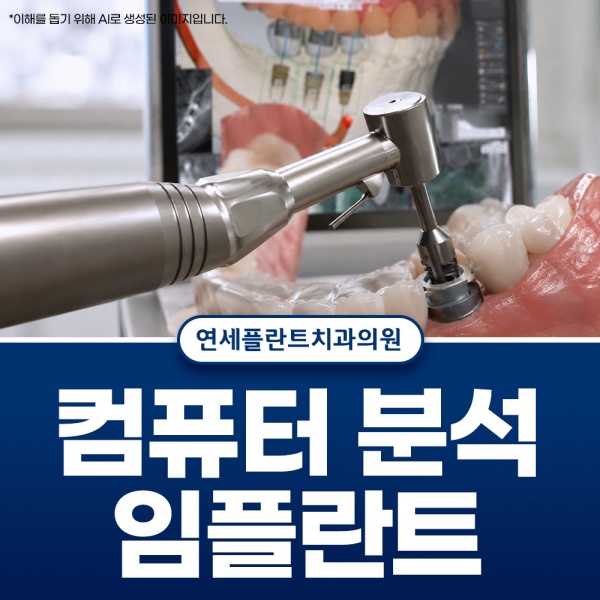 5. 컴퓨터 분석 임플란트.jpg